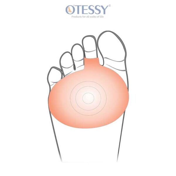 Silicone Metatarsal Pad with Ring Model: TM 34