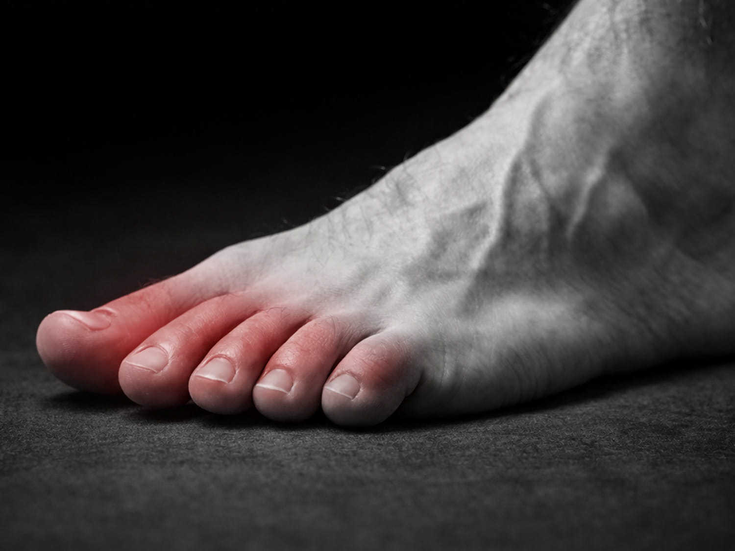 Foot-&-Metatarsal-Support-min