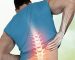 Symptoms-and-types-of-lumbar-vertebrae-fractures-min